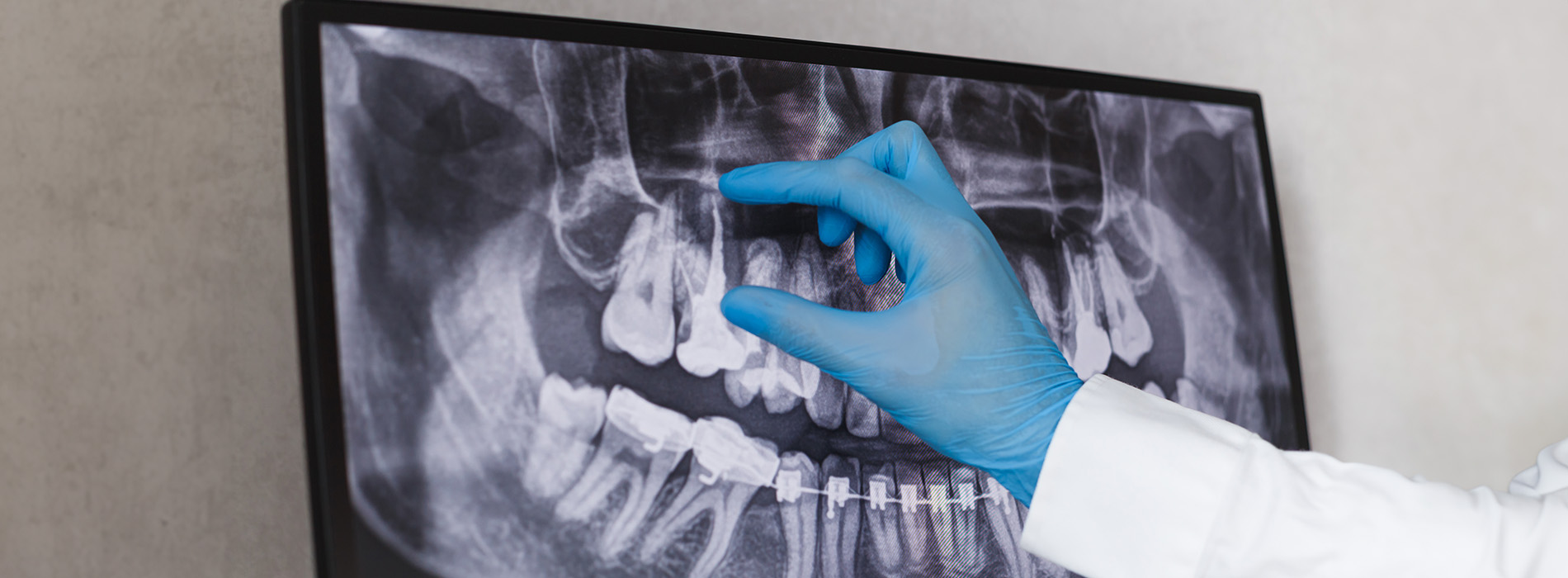 Northern Star Oral and Maxillofacial Surgery LLC | Apicoectomy, Corrective Jaw Surgery and Nitrous Oxide