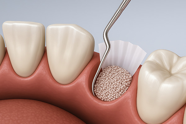 Northern Star Oral and Maxillofacial Surgery LLC | Corrective Jaw Surgery, Nitrous Oxide and Wisdom Teeth